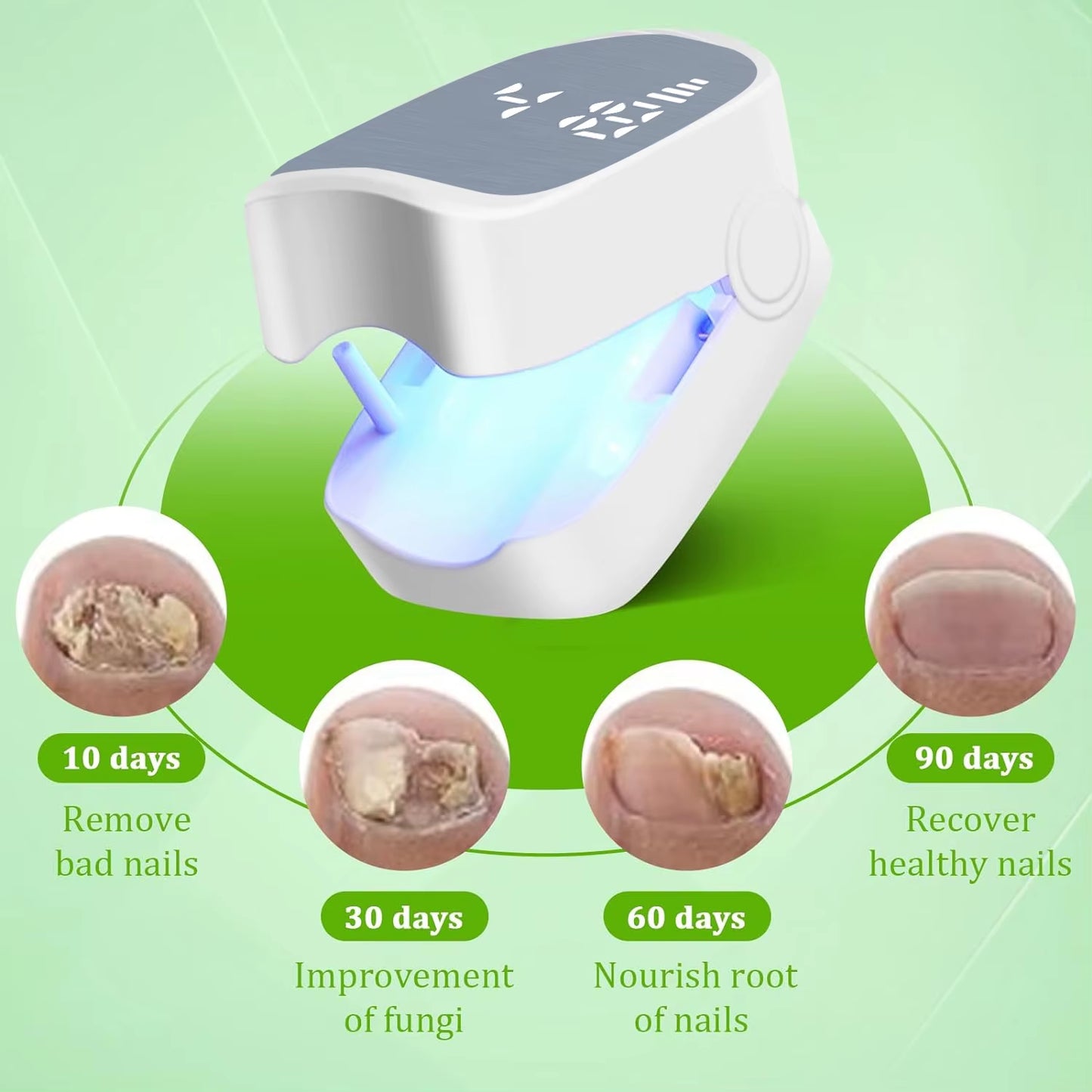 Nail Fungus Treatment Tools Fungal Nail Treatment Device Anti-Equipment Effectively Remove Fungal Toenail Nail Fungal Infection