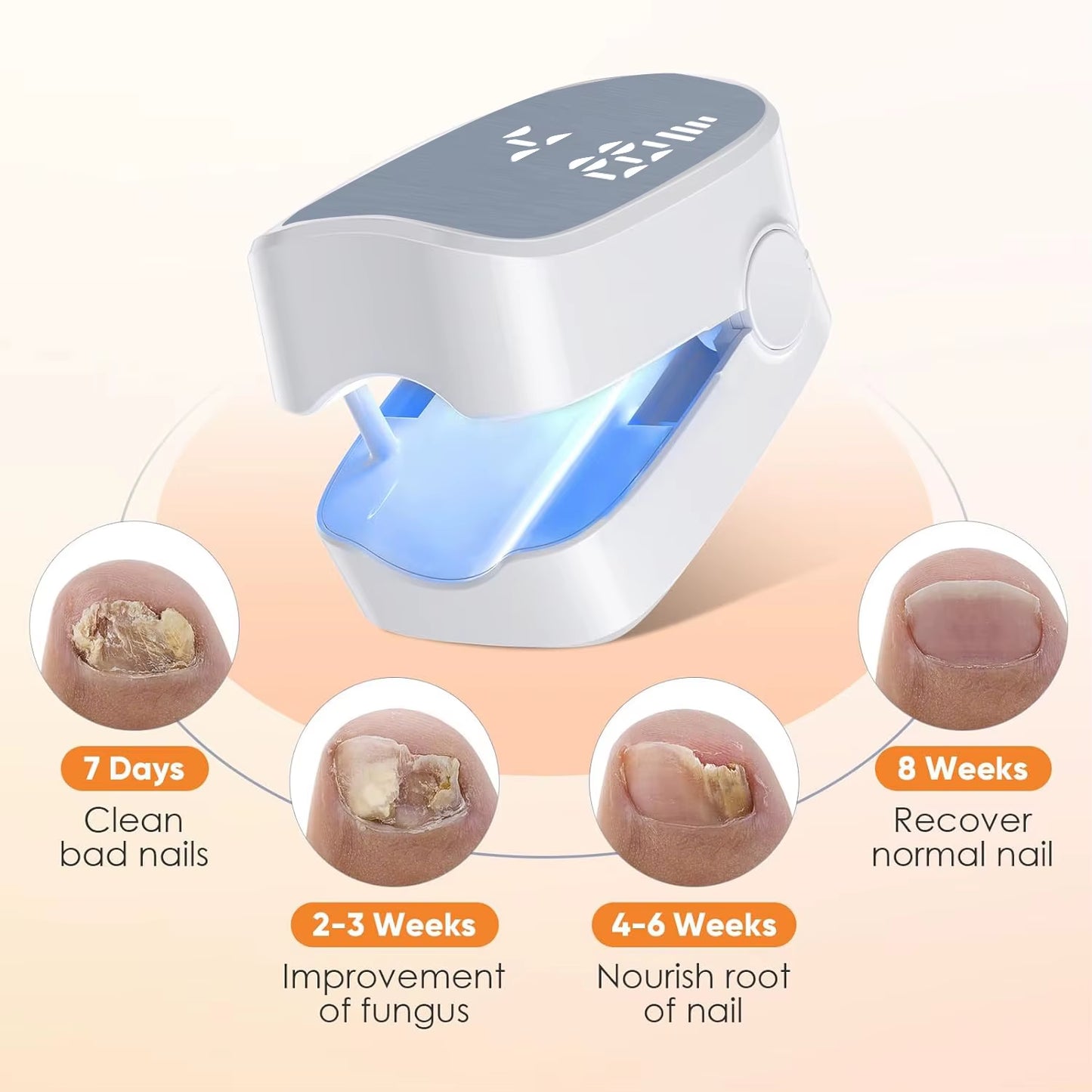 Nail Fungus Treatment Tools Fungal Nail Treatment Device Anti-Equipment Effectively Remove Fungal Toenail Nail Fungal Infection